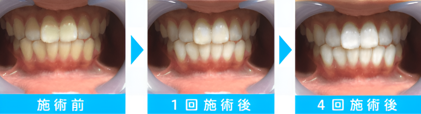 30代／女性