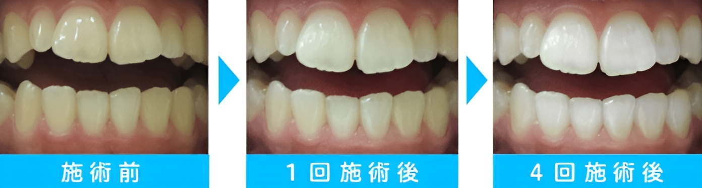 30代／女性