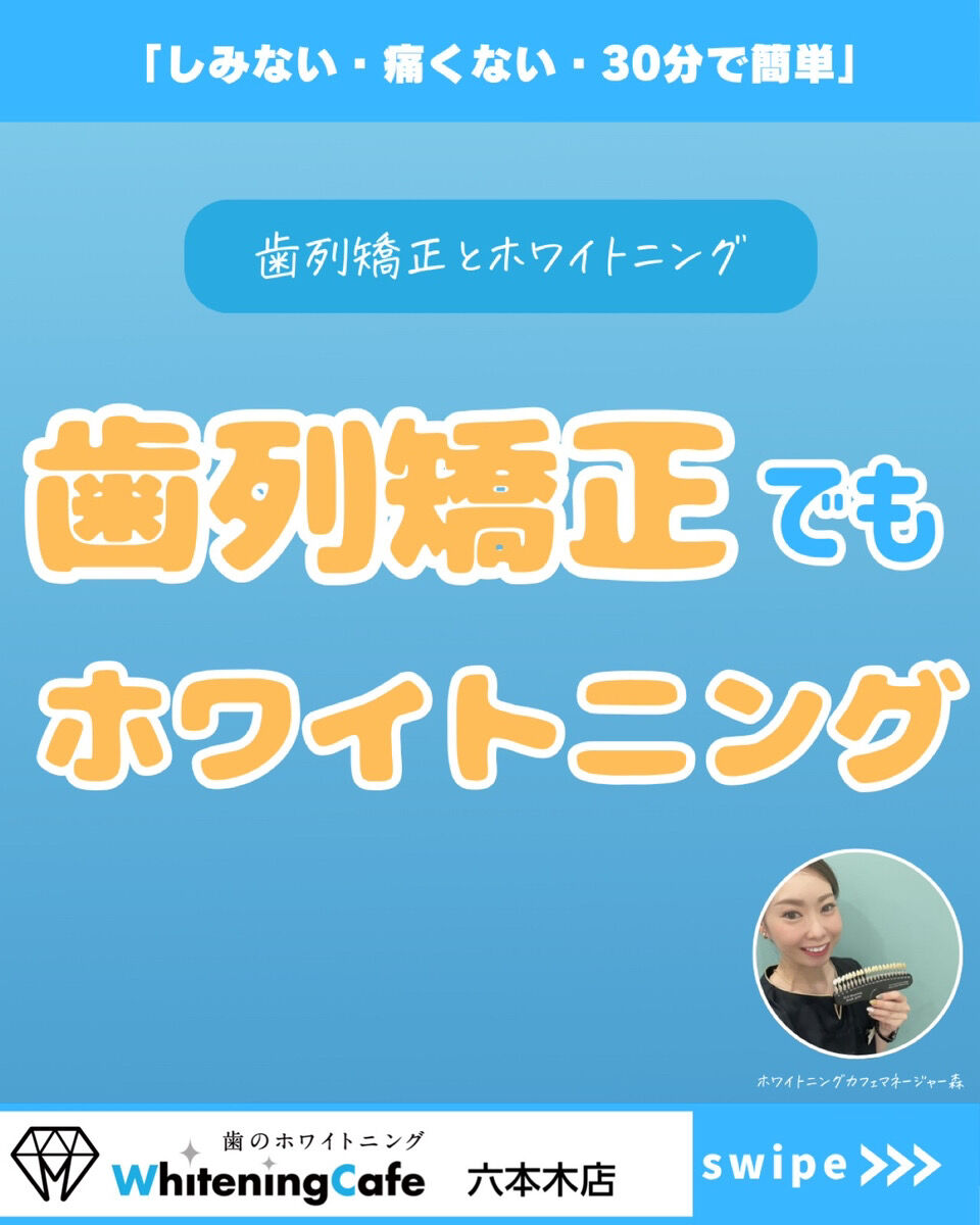【ホワイトニングカフェ六本木店】歯列矯正でもホワイトニングできる？