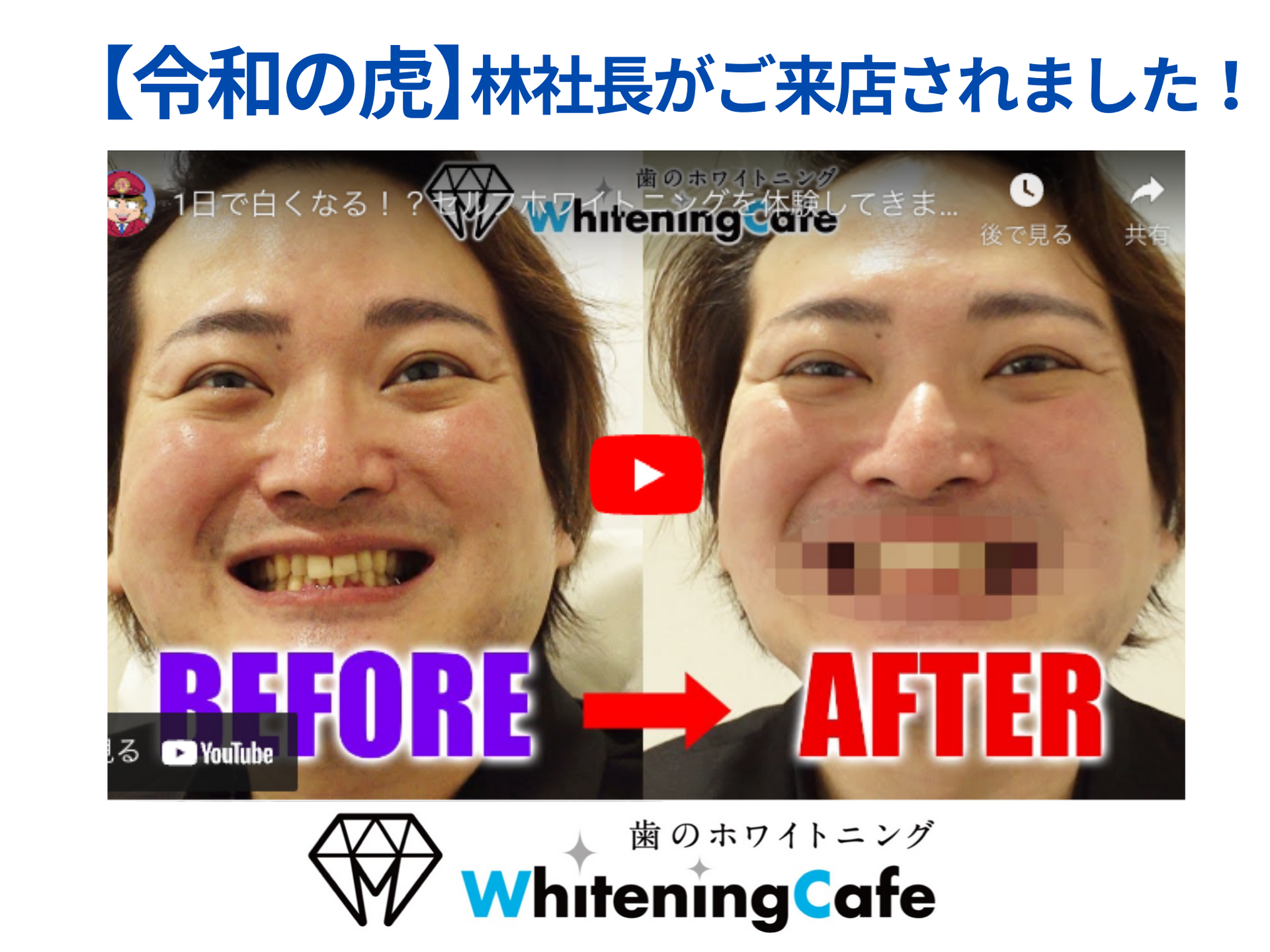 【ホワイトニングカフェ六本木店】林社長ご来店◎白い歯の魅力♪