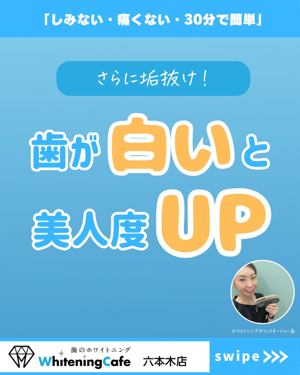 【ホワイトニングカフェ六本木店】歯が白いと美人度アップ↑↑
