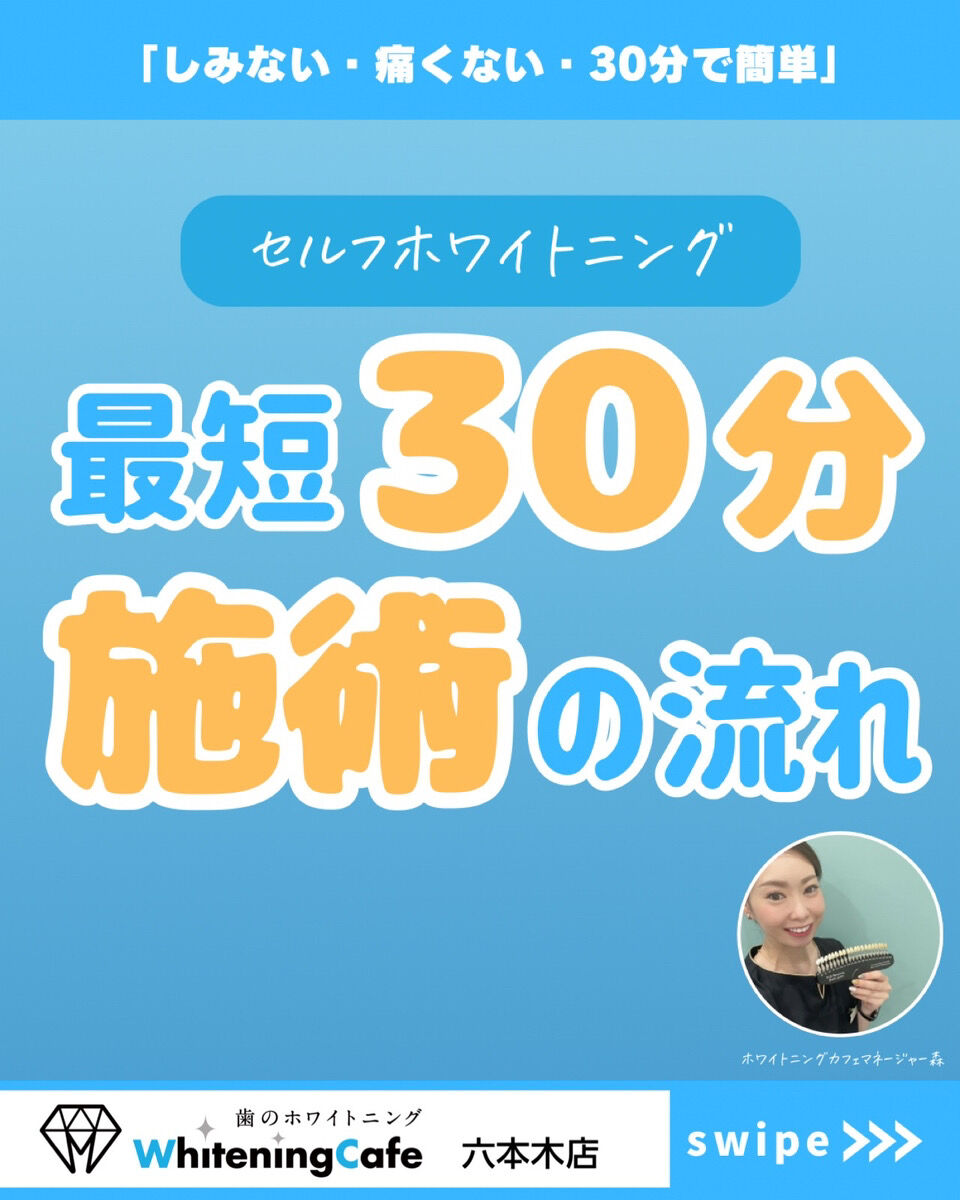 【ホワイトニングカフェ六本木店】ホワイトニングどのくらい時間かかる？