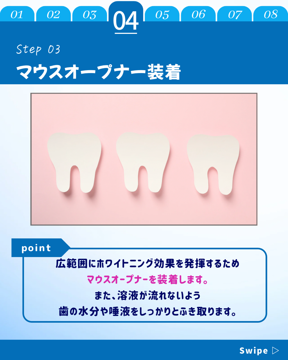 【ホワイトニングカフェ六本木店】ホワイトニングどのくらい時間かかる？