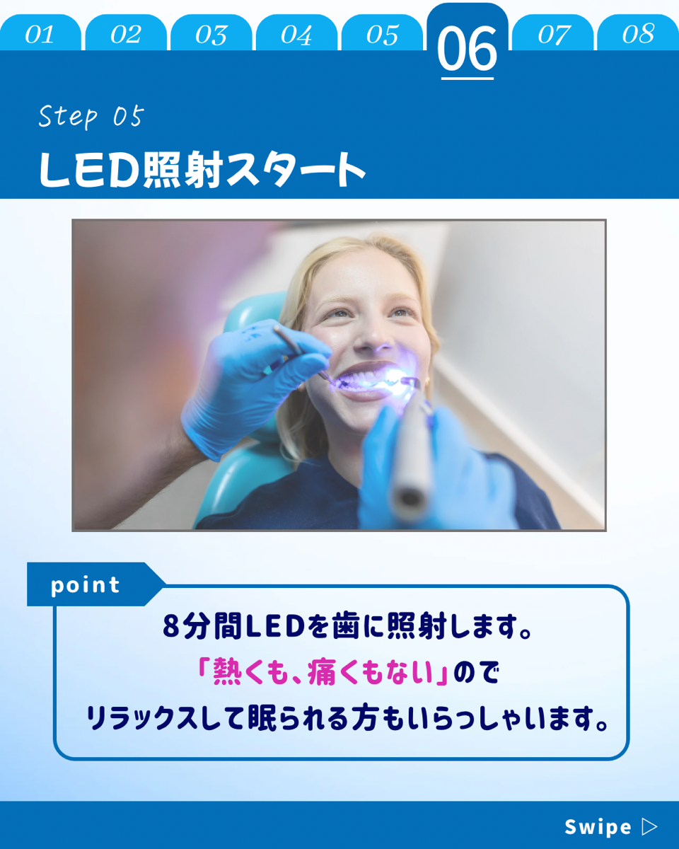 【ホワイトニングカフェ六本木店】ホワイトニングどのくらい時間かかる？