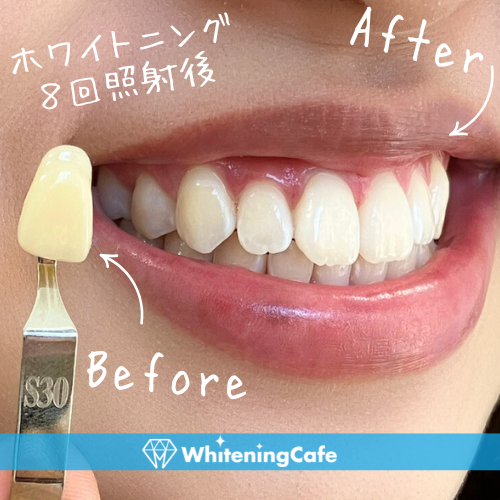 30代／女性