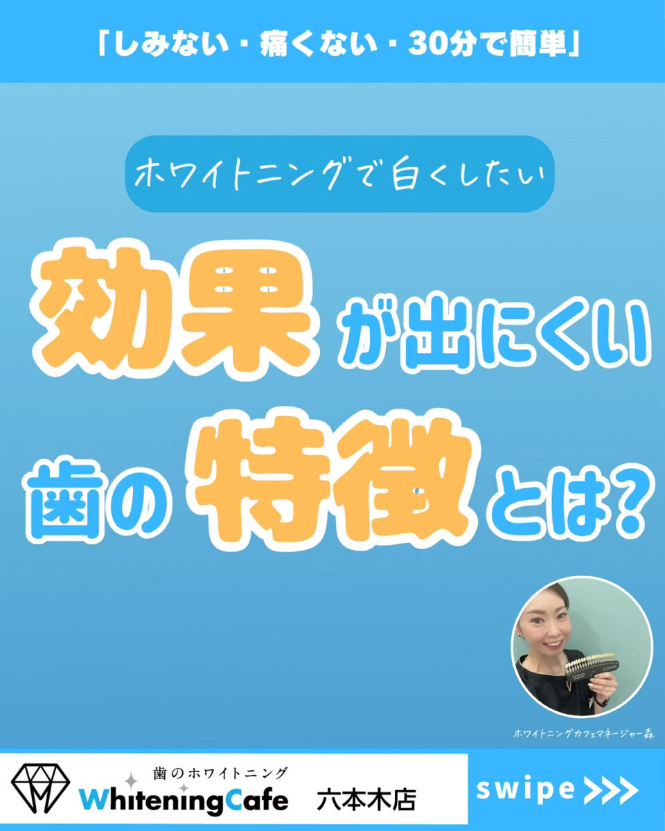 【ホワイトニングカフェ六本木店】効果が出やすい歯の特徴とは？