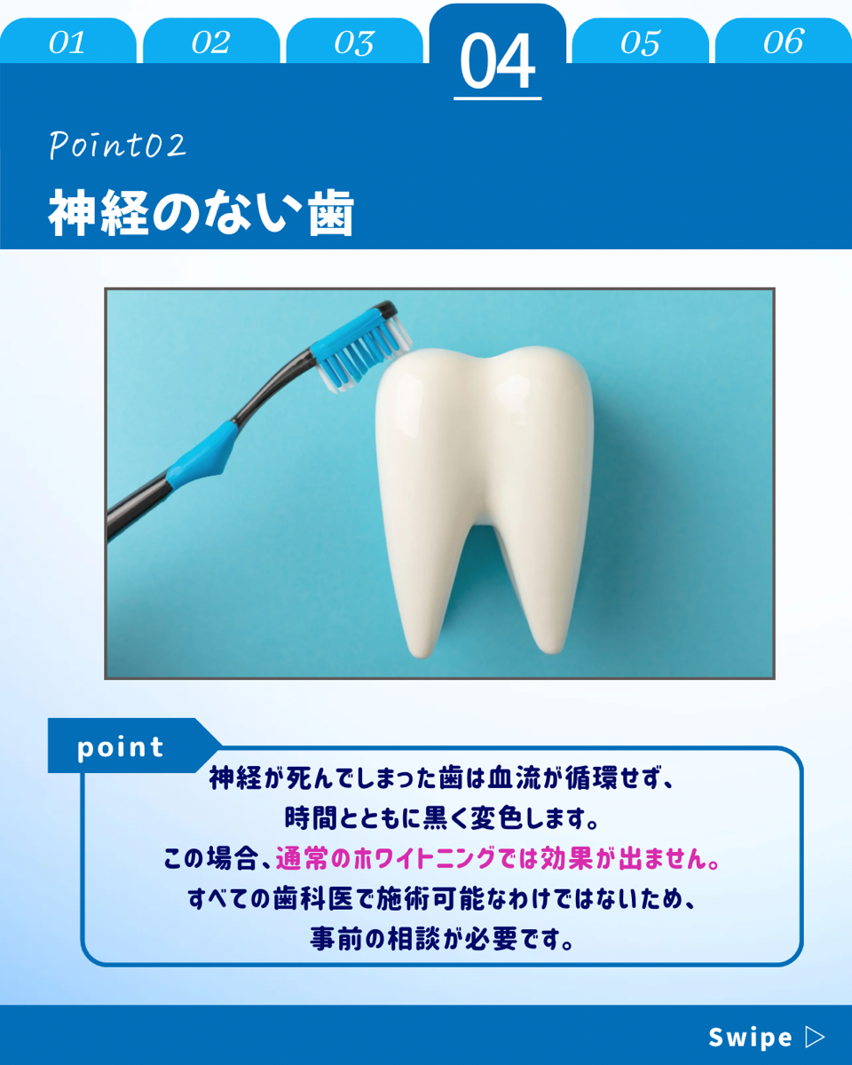 【ホワイトニングカフェ六本木店】効果が出やすい歯の特徴とは？