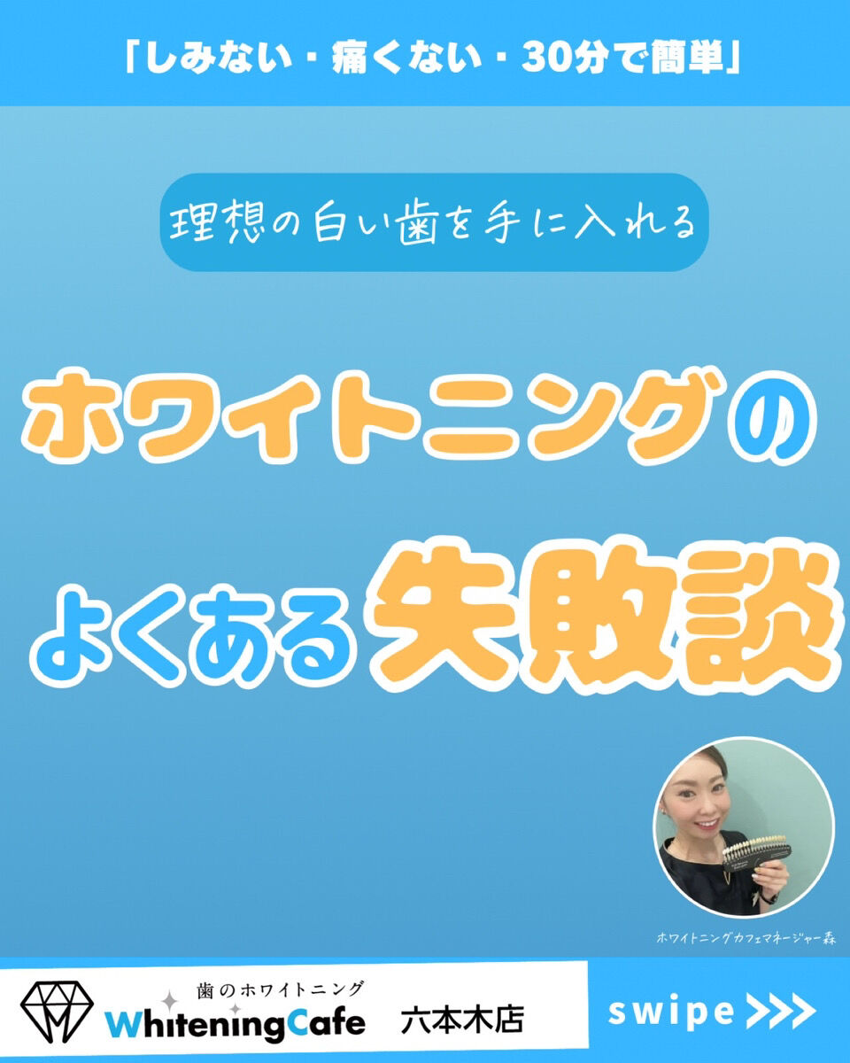 【ホワイトニングカフェ六本木店】ホワイトニングのよくある失敗談について