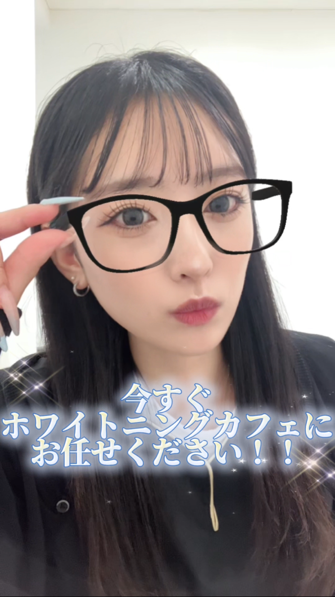 【ホワイトニングカフェ六本木店】ホワイトニングをしようと思う瞬間！！