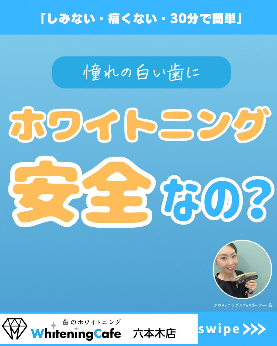 【ホワイトニングカフェ六本木店】実際ホワイトニングって安全なの？