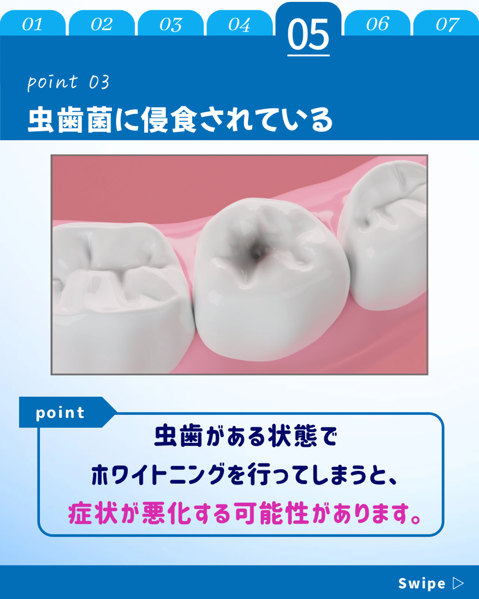 【ホワイトニングカフェ六本木店】