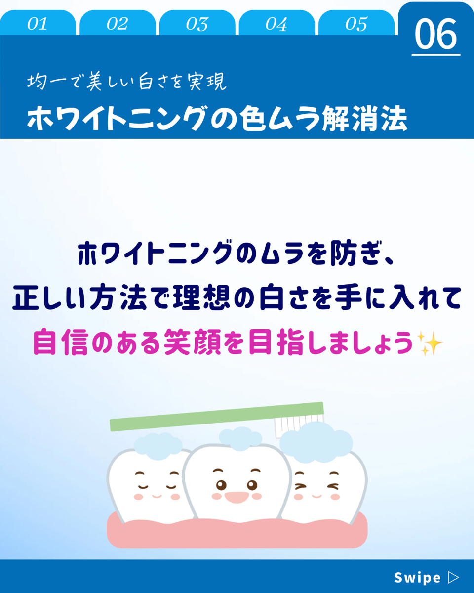 【ホワイトニングカフェ六本木店】ホワイトニング後「色ムラ」になった経験は❓