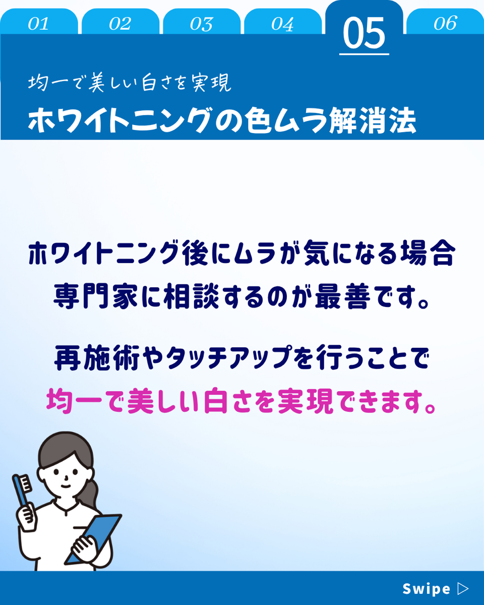 【ホワイトニングカフェ六本木店】ホワイトニング後「色ムラ」になった経験は❓