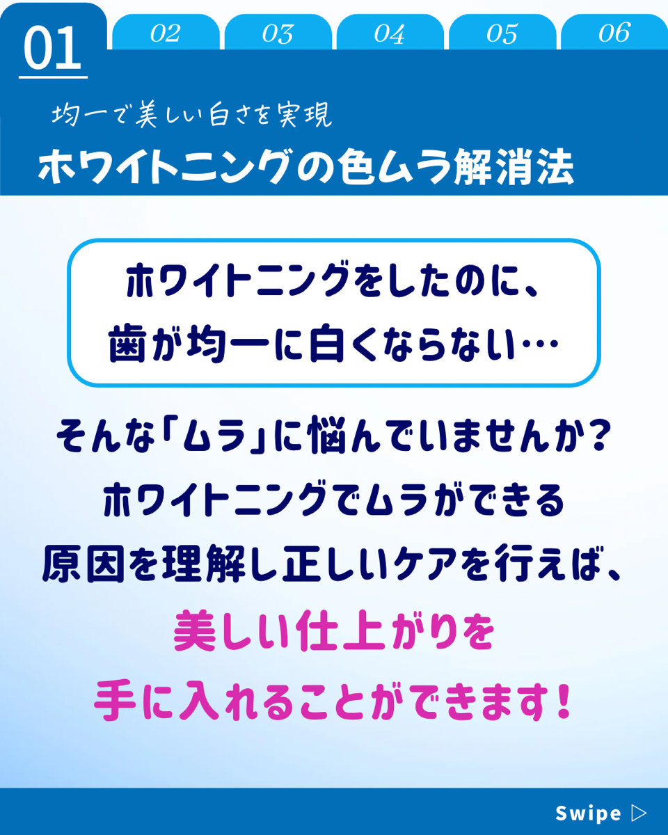 【ホワイトニングカフェ六本木店】ホワイトニング後「色ムラ」になった経験は❓