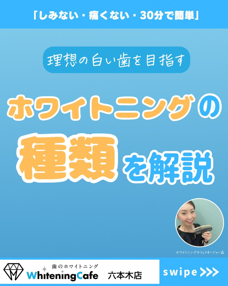 【ホワイトニングカフェ六本木店】ホワイトニングの種類を解説！