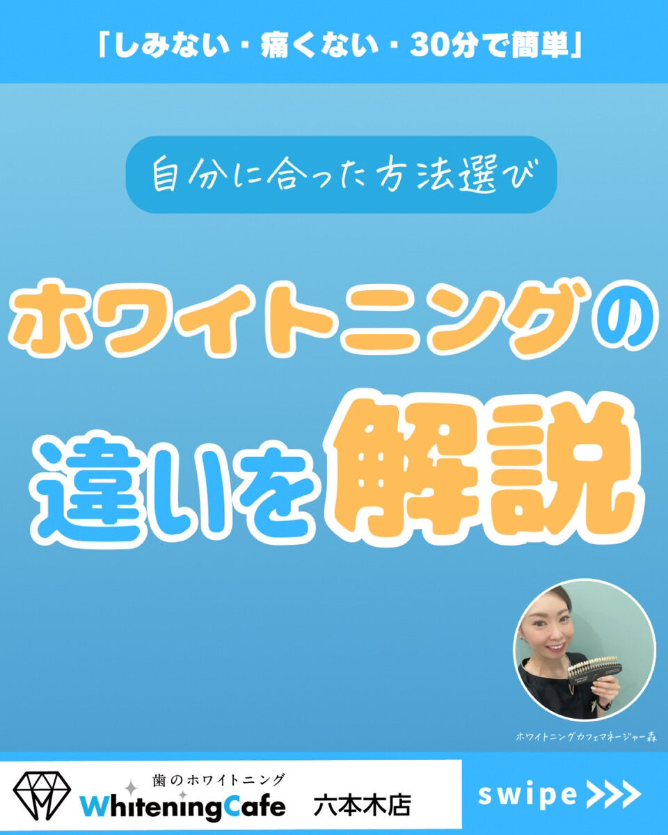 【ホワイトニングカフェ六本木店】ホワイトニング種類の違いについて🌟