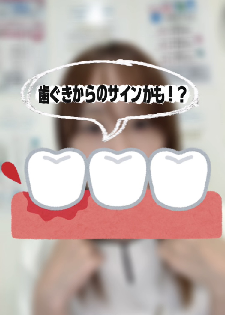 【ホワイトニングカフェ六本木店】歯磨きで血が出る…歯ぐきからのサイン？