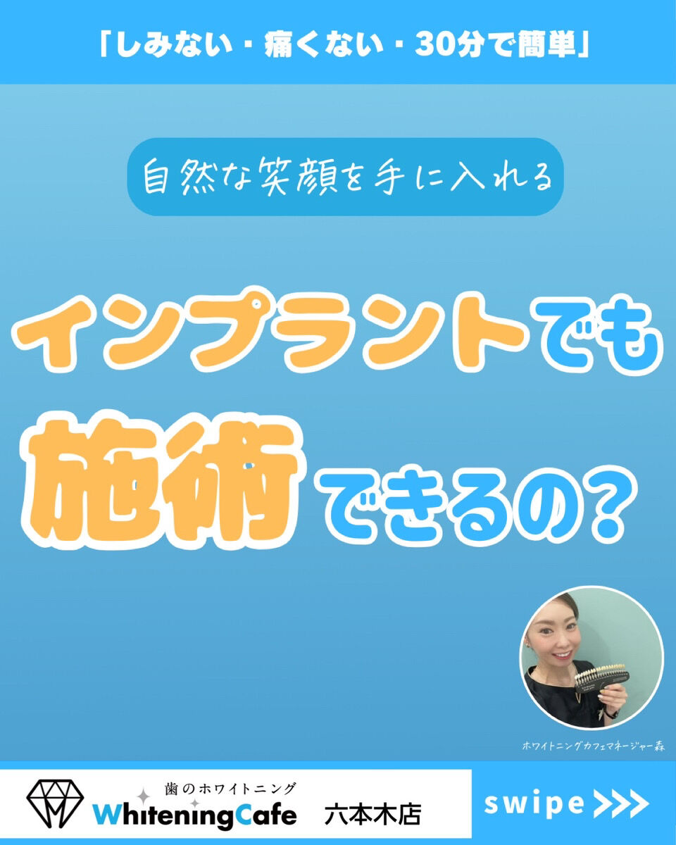 【ホワイトニングカフェ六本木店】インプラントは施術できる？？