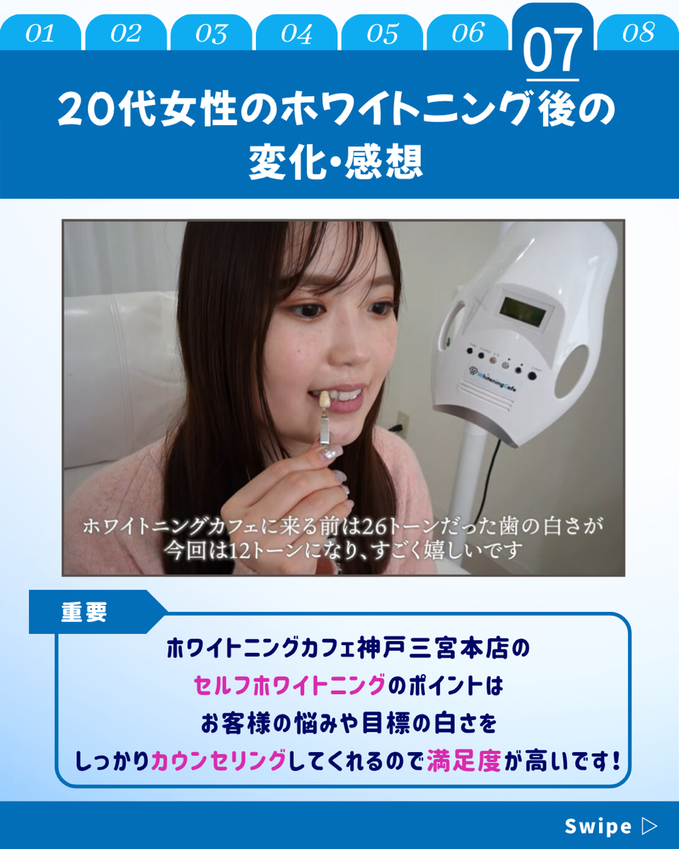 【ホワイトニングカフェ六本木店】20代　女性　ホワイトニング体験(^^♪