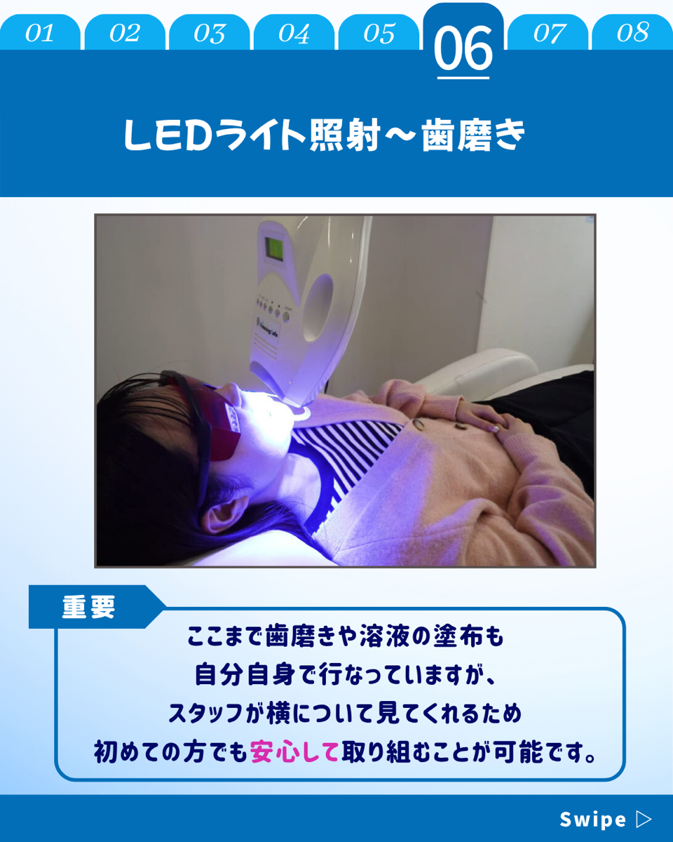 【ホワイトニングカフェ六本木店】20代　女性　ホワイトニング体験(^^♪