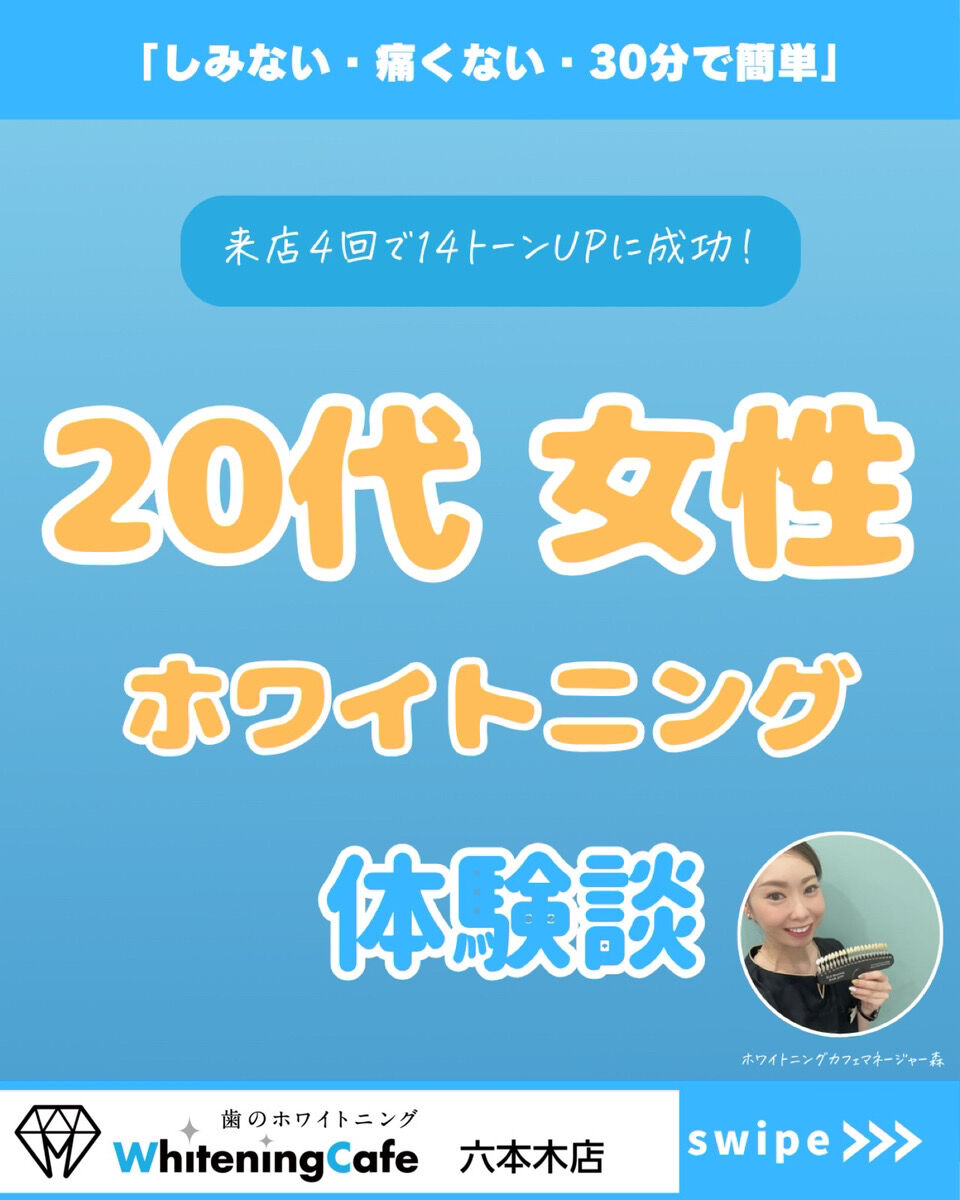 【ホワイトニングカフェ六本木店】20代　女性　ホワイトニング体験(^^♪