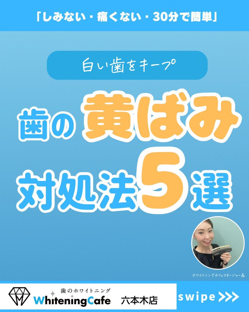 【ホワイトニングカフェ六本木店】歯の黄ばみ対処法5選