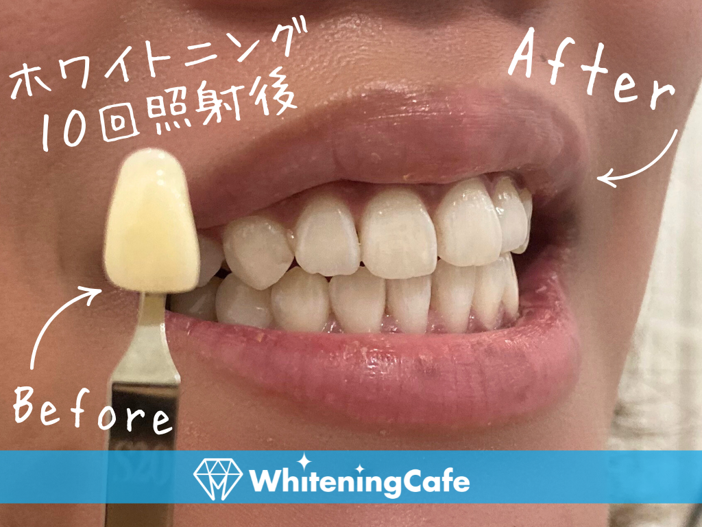 30代／女性