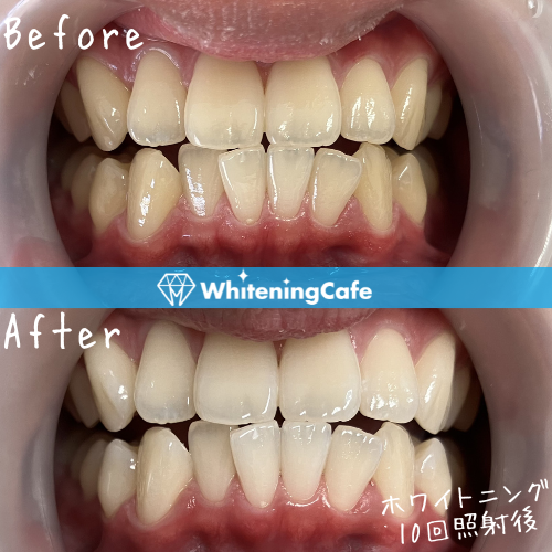 20代／公務員／男性