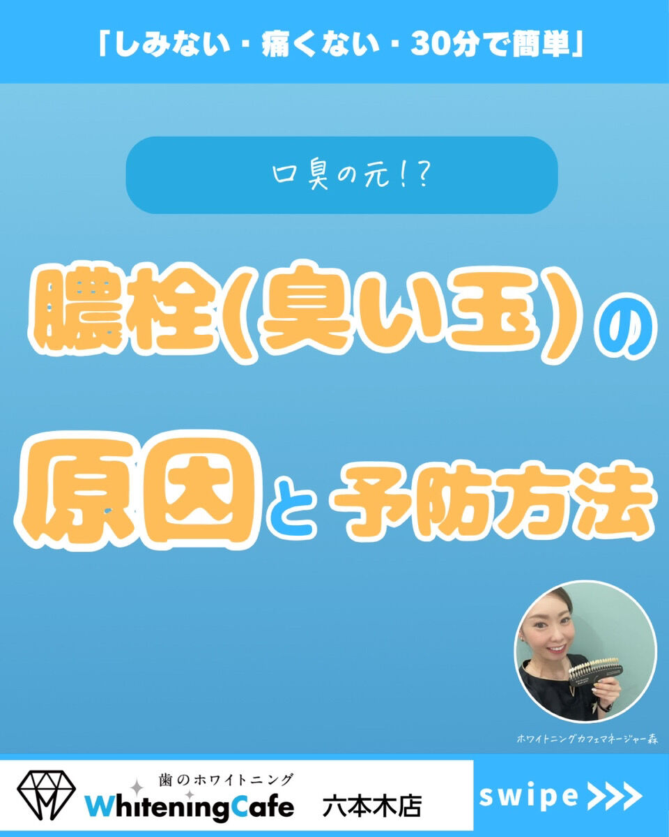 【ホワイトニングカフェ六本木店】臭い玉って何？できる原因や口臭との関係