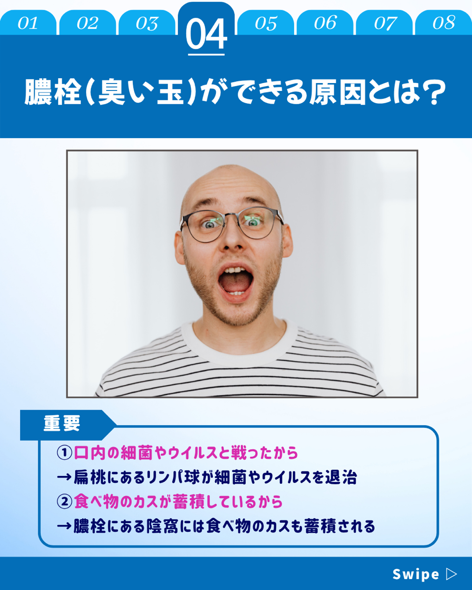 【ホワイトニングカフェ六本木店】臭い玉って何？できる原因や口臭との関係