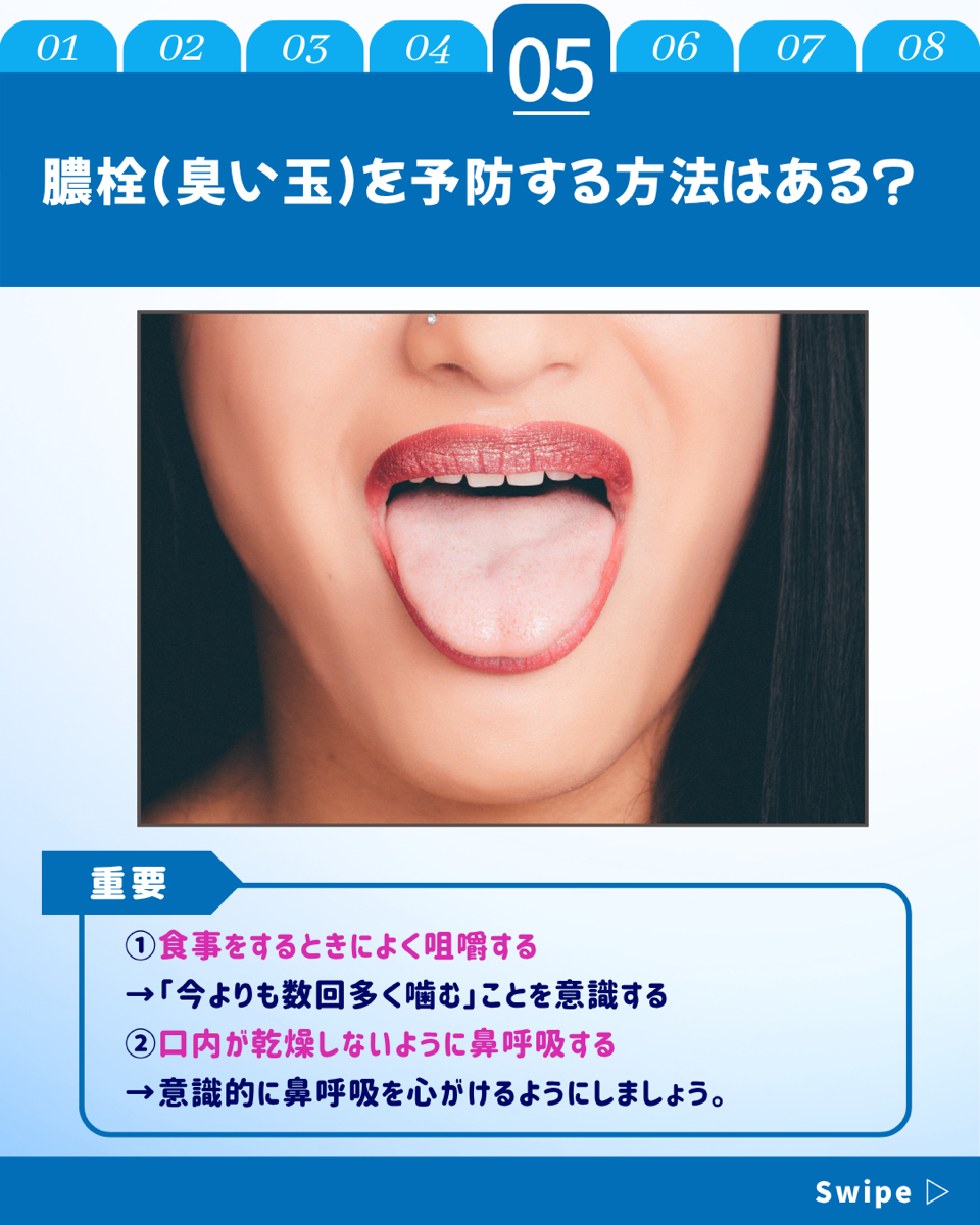 【ホワイトニングカフェ六本木店】臭い玉って何？できる原因や口臭との関係