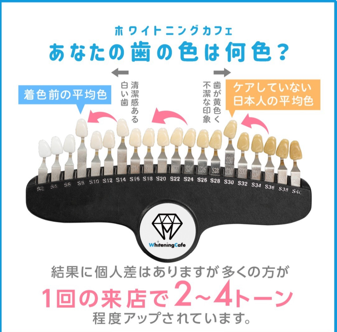 【ホワイトニングカフェ六本木店】1回のホワイトニングでどのくらい白くなる？