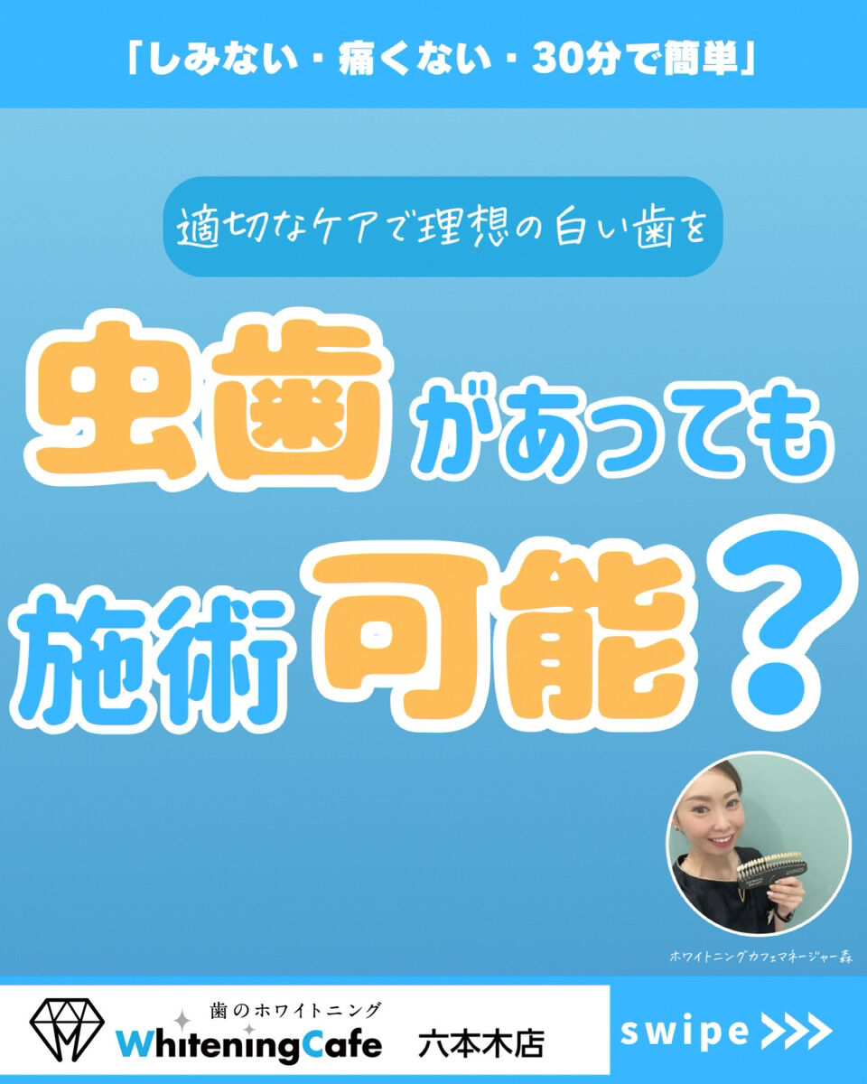 【ホワイトニングカフェ六本木店】虫歯でもホワイトニングできる？