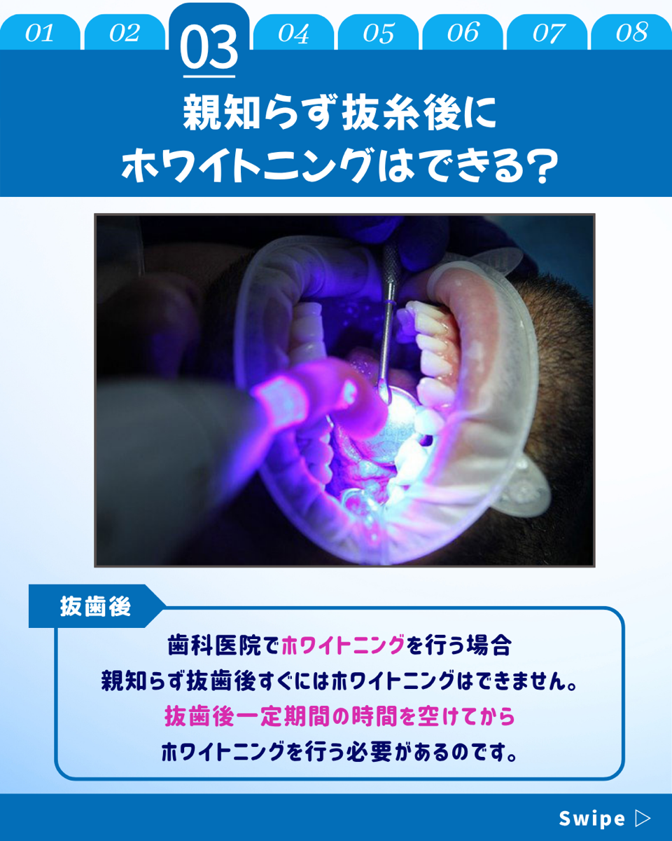 【ホワイトニングカフェ六本木店】親知らず抜歯後のホワイトニング❓