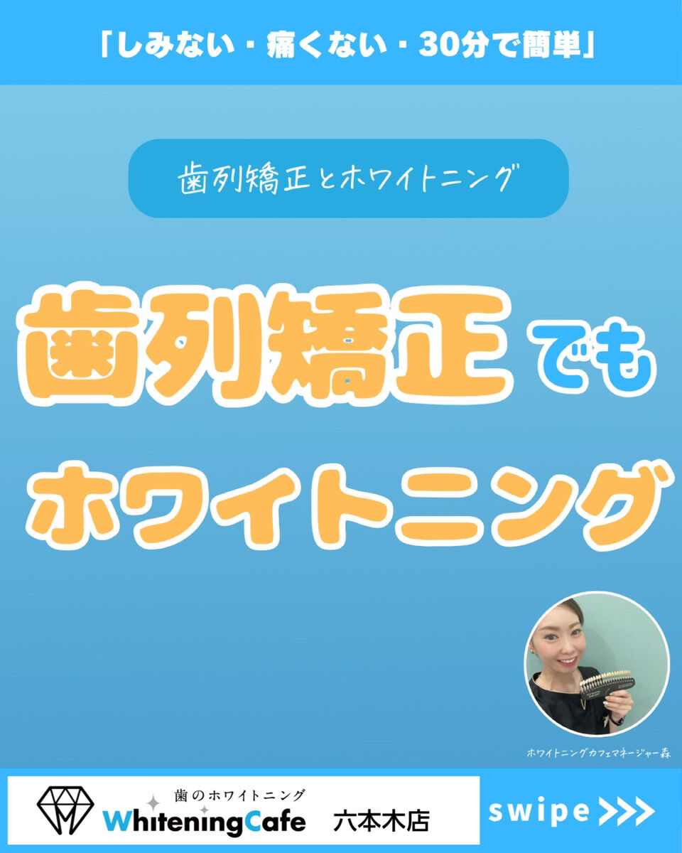【ホワイトニングカフェ六本木店】歯列矯正でもホワイトニング