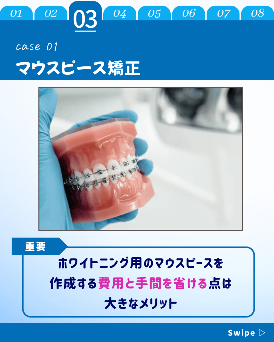【ホワイトニングカフェ六本木店】歯列矯正でもホワイトニング