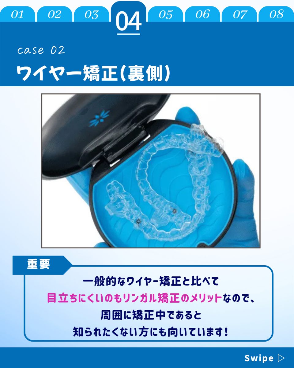 【ホワイトニングカフェ六本木店】歯列矯正でもホワイトニング