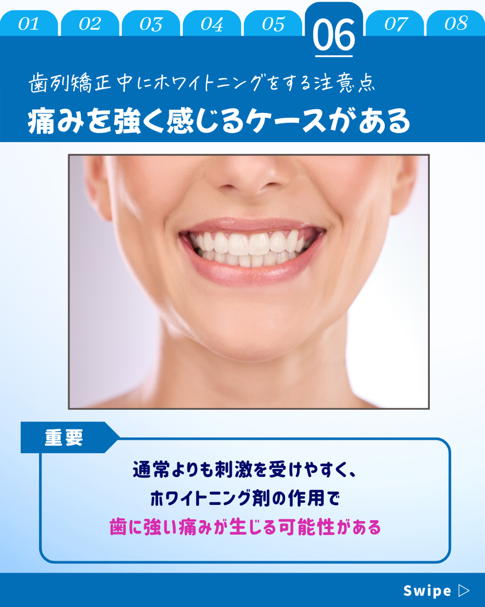 【ホワイトニングカフェ六本木店】歯列矯正でもホワイトニング
