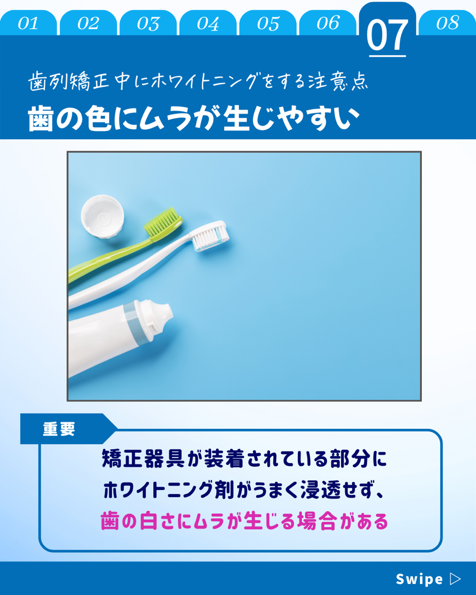 【ホワイトニングカフェ六本木店】歯列矯正でもホワイトニング