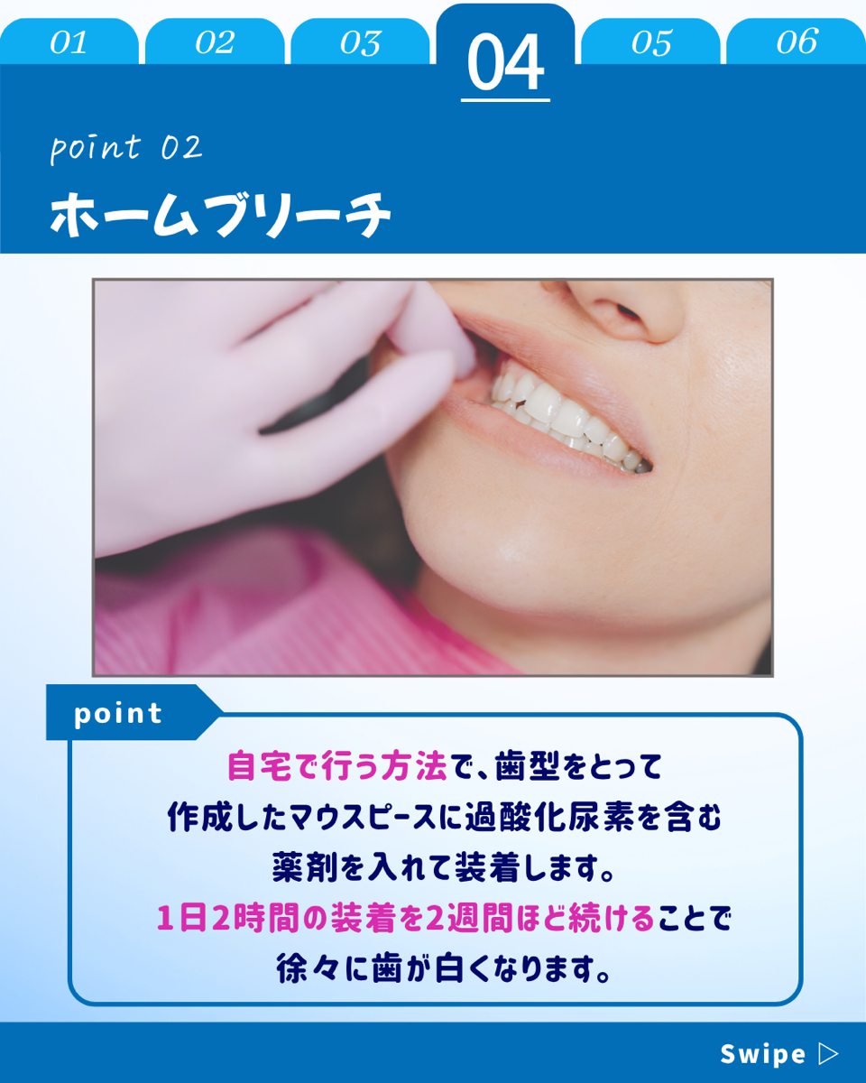 【ホワイトニングカフェ六本木店】歯を白くする3つの方法🎶