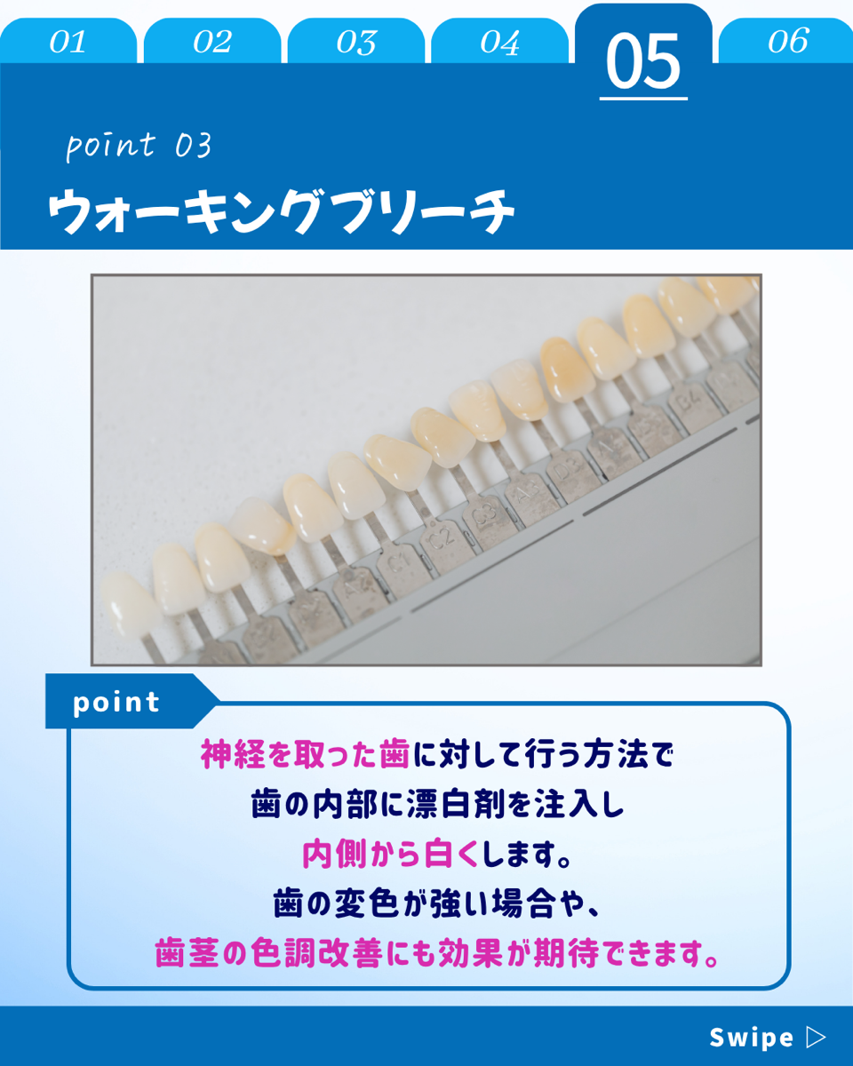 【ホワイトニングカフェ六本木店】歯を白くする3つの方法🎶