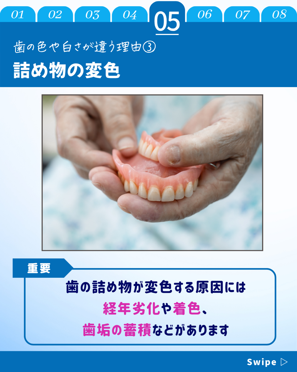 【ホワイトニングカフェ六本木店】歯の色が人それぞれの理由