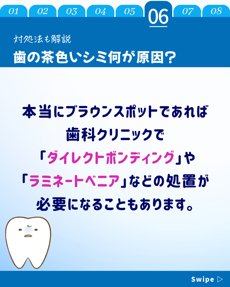 【ホワイトニングカフェ六本木店】歯の茶色いシミはな～に？