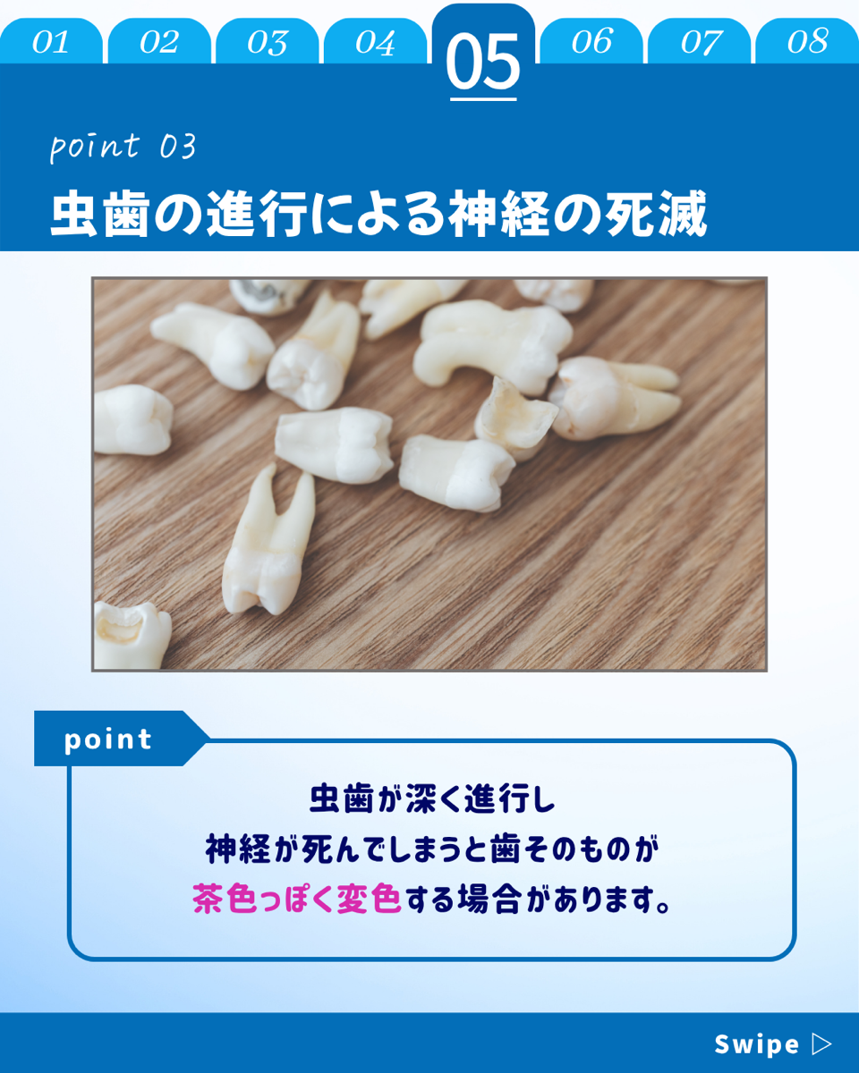 【ホワイトニングカフェ六本木店】歯の茶色いシミはな～に？