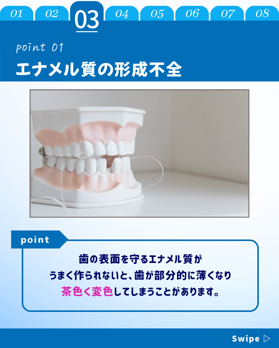 【ホワイトニングカフェ六本木店】歯の茶色いシミはな～に？