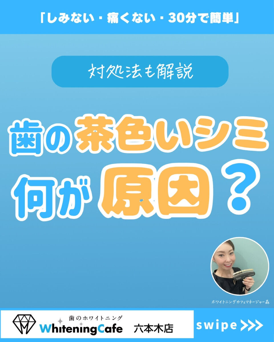 【ホワイトニングカフェ六本木店】歯の茶色いシミはな～に？