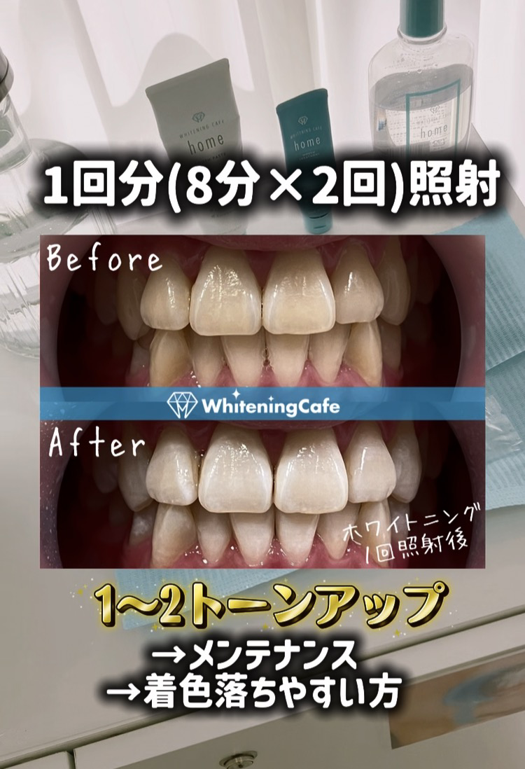 【ホワイトニングカフェ六本木店】ホワイトニングカフェメニューの効果の違い◎