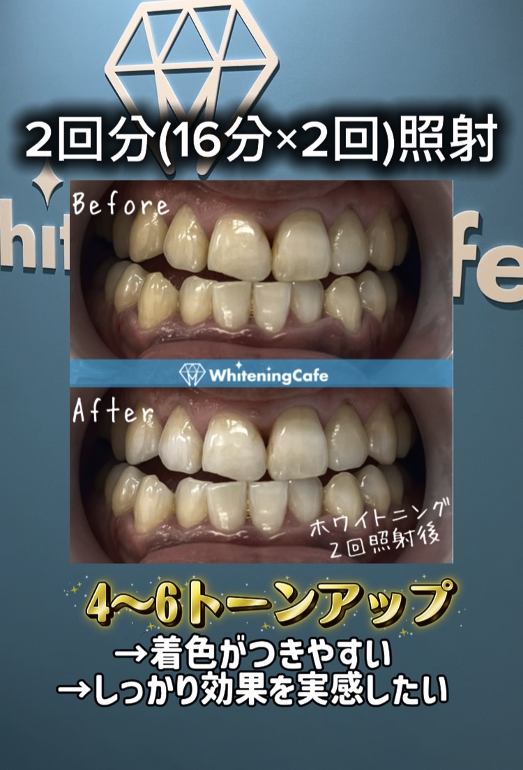 【ホワイトニングカフェ六本木店】ホワイトニングカフェメニューの効果の違い◎