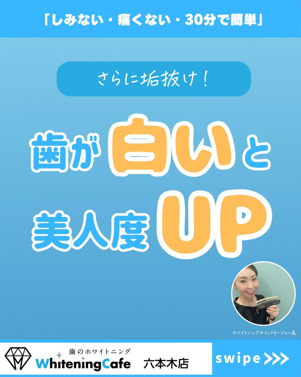 【ホワイトニングカフェ六本木店】垢抜けたい女子必見👀