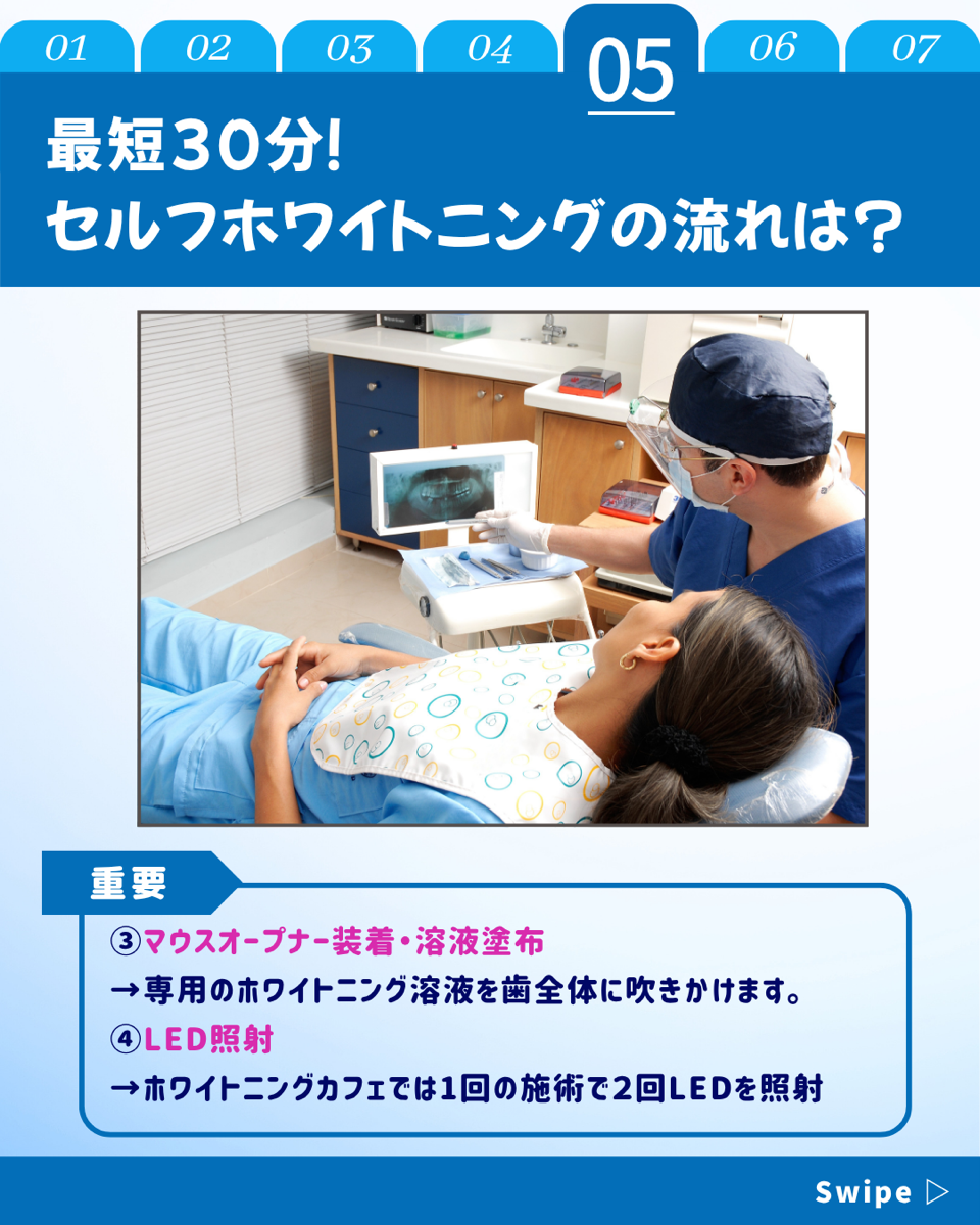 【ホワイトニングカフェ六本木店】施術が終わるまで何分かかる❓